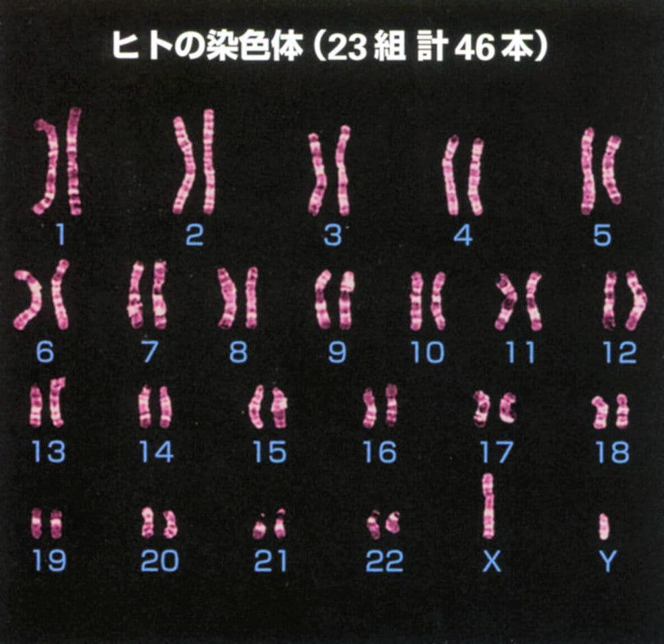 ヒトの染色体(末期癌からの生還)